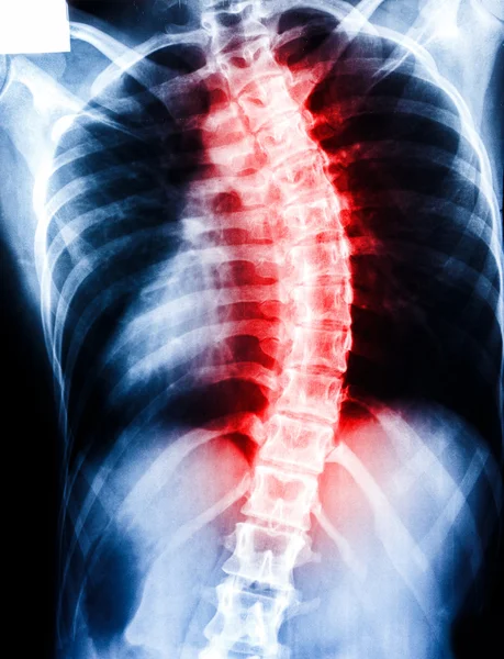 Röntgen scan mänskliga — Stockfoto