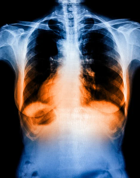 X-Ray scan human — Stock Photo, Image