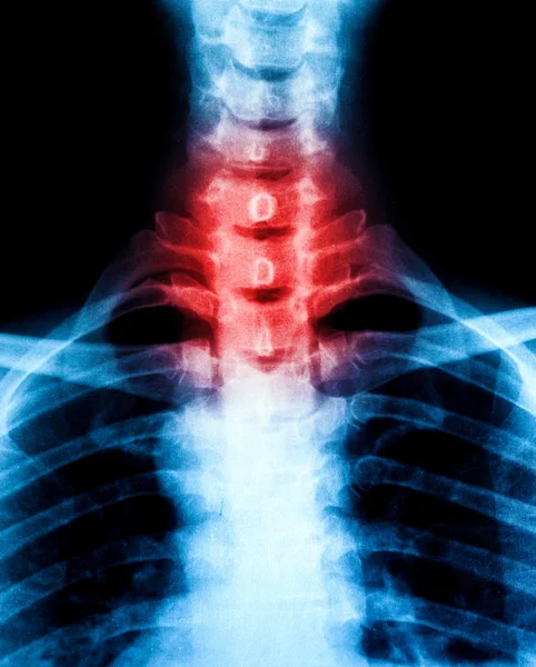 X-Ray scan human — Stock Photo, Image