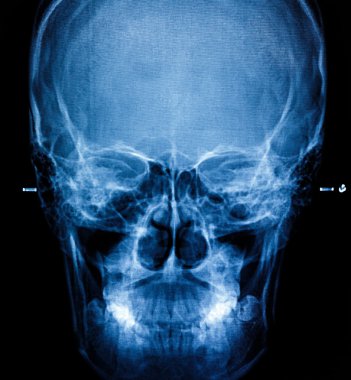 Fotoğraf x-ray tarama insan 