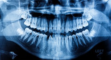 Fotoğraf x-ray tarama insan 
