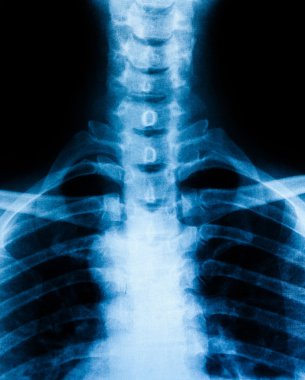 Fotoğraf x-ray tarama insan 