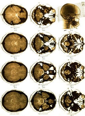 Fotoğraf x-ray tarama insan 