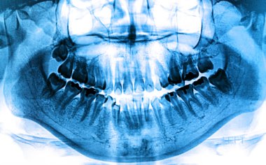 Fotoğraf x-ray tarama insan 