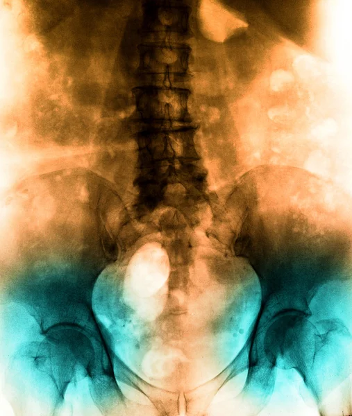 X-ray scan mens — Stockfoto