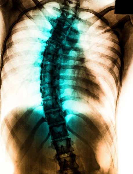 X-Ray scan human — Stock Photo, Image