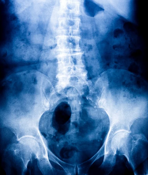 Фото рентгенівського сканування людини — стокове фото