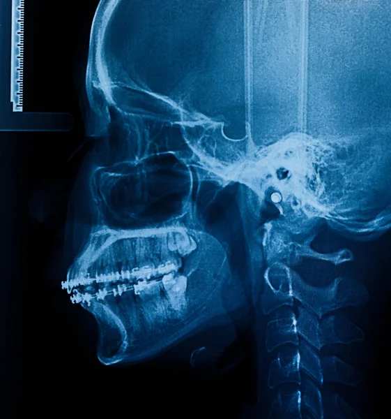 Photo X-Ray scan human — Stock Photo, Image