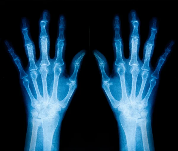 Photo X-Ray scan human — Stock Photo, Image