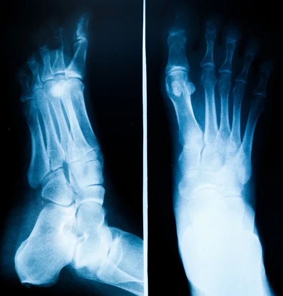 Photo X-Ray scan human — Stock Photo, Image