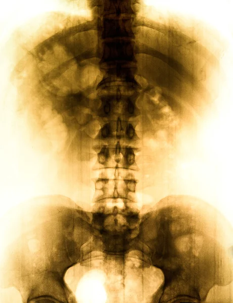 Foto x-ray scan menselijke — Stockfoto