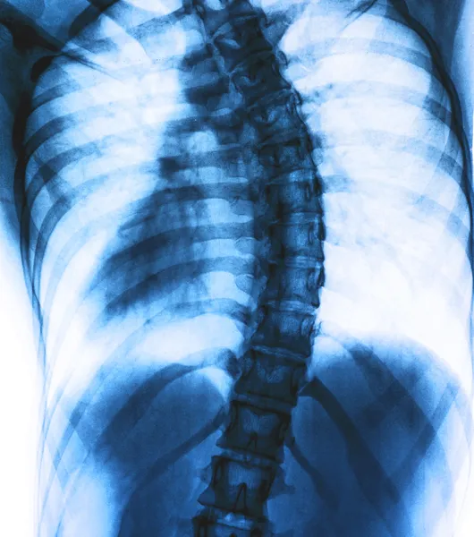 Photo X-Ray scan human — Stock Photo, Image