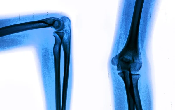 Photo X-Ray scan human — Stock Photo, Image