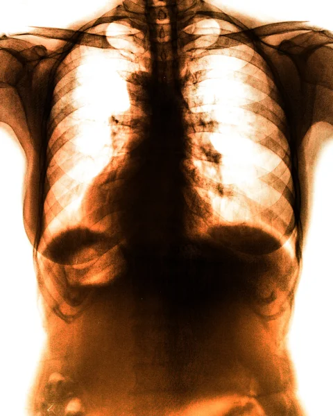 Photo X-Ray scan human — Stock Photo, Image