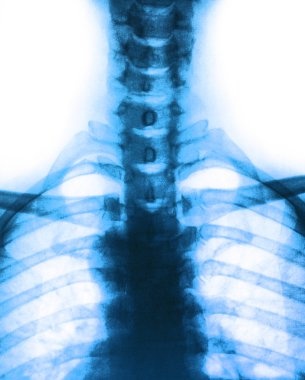 Fotoğraf x-ray tarama insan 