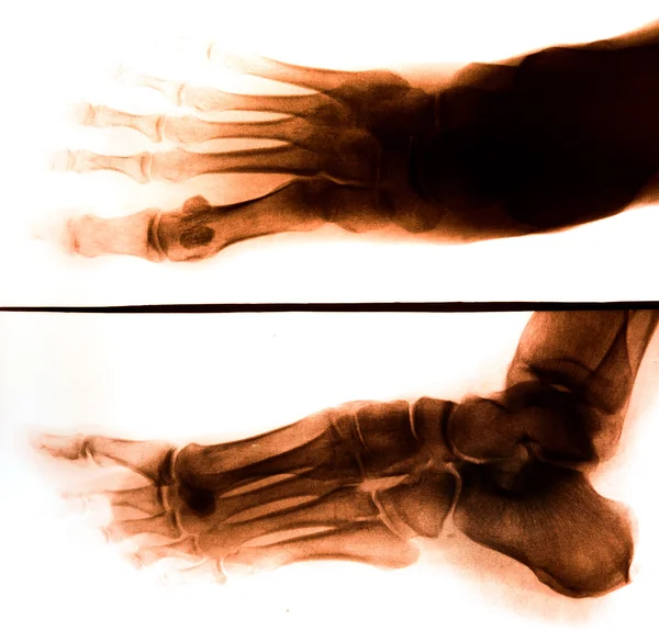 Photo X-Ray scan human — Stock Photo, Image