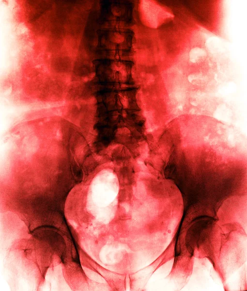 Photo X-Ray scan humain — Photo