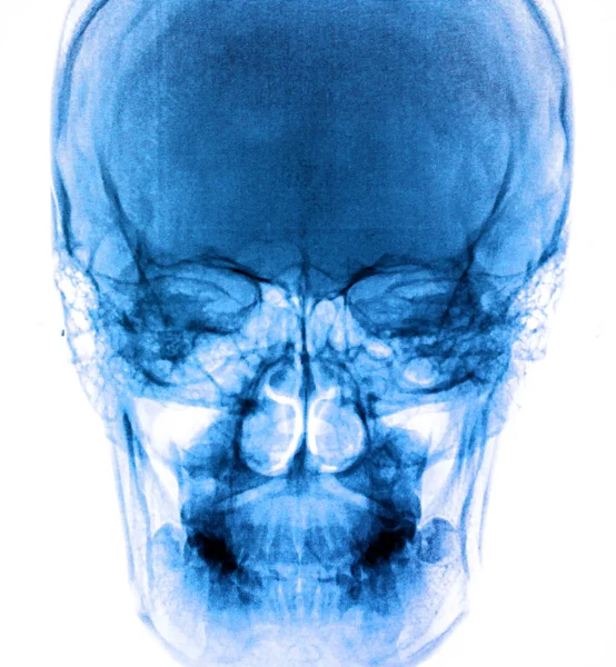 Foto X-Ray scansione umana — Foto Stock