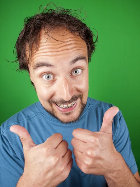 Happy man with braces putting his thumbs up for you — Stock Photo, Image