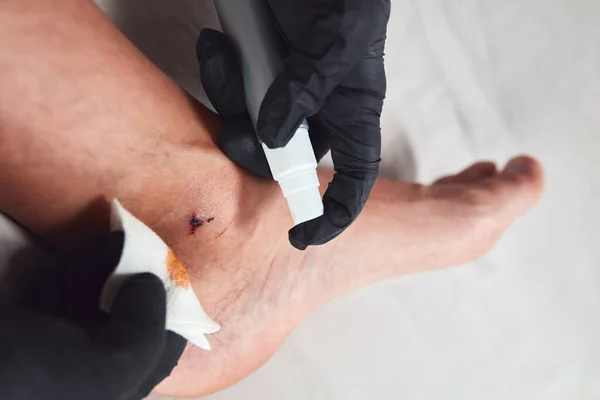 Man\'s ankle with cut skin and scabby wound treated for sterilization.