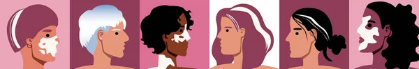 Huid Met Vitiligo Multiculturele Vrouwen Platte Vectorvoorraadillustratie Huidziekte Depigmentatieplekken Schoonheid — Stockvector