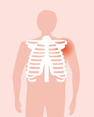 İnsan organı, omurga, eklem ağrısı. Düz vektör stok çizimi. Hastalık kavramı olarak soyut insan
