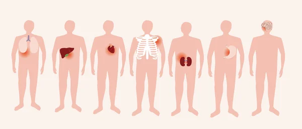 Ból Ciała Izolowani Ludzie Ludzkimi Organami Sekcji Płaska Ilustracja Wektora — Wektor stockowy