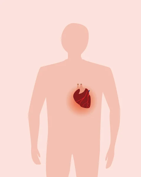 Nsan Kalbi Için Acı Verici Düz Vektör Stok Çizimi Kalp — Stok Vektör