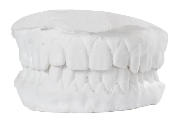 Dental gypsum model mould of teeth in plaster isolated on white background — Stock Photo, Image
