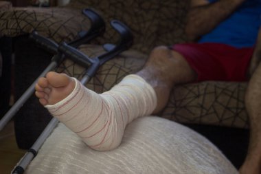 Yetişkin bir erkeğin yatay görüntüsü. Bacağı alçıda ve koltuk değnekleriyle bir tabureye sarılı. Ciddi fiziksel yaralanmalardan sonra insanların rehabilitasyonu