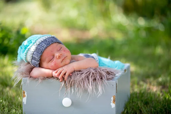 Cute Newborn Baby Boy Severe Skin Rash His Face Sleeping — Stock Photo, Image