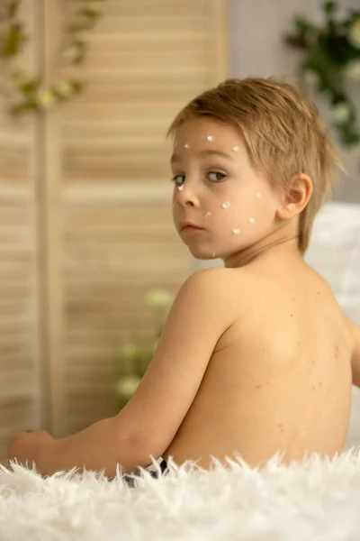 Toddler Boy Chicken Pox Lying Bed Fever Mother Checking Him — Stock Fotó