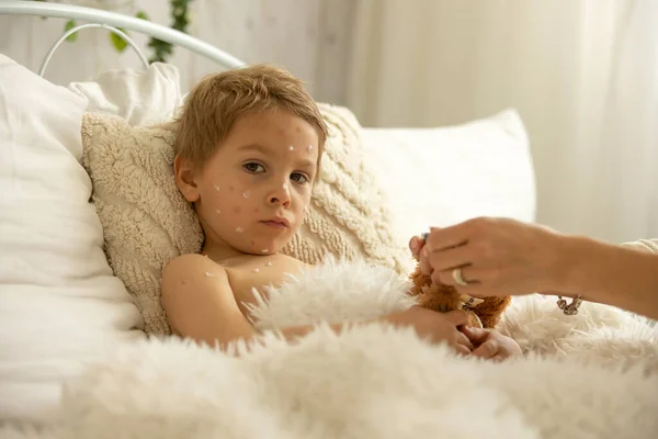 Toddler Boy Chicken Pox Lying Bed Fever Mother Checking Him — Stock Fotó