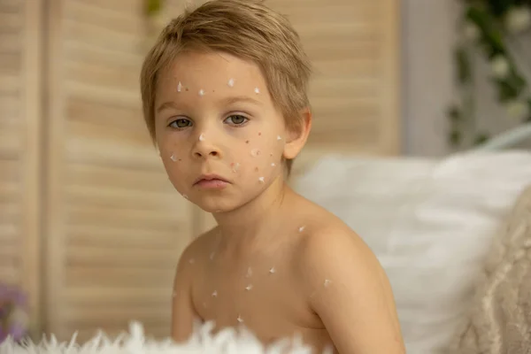 Toddler Boy Chicken Pox Lying Bed Fever Mother Checking Him — стоковое фото