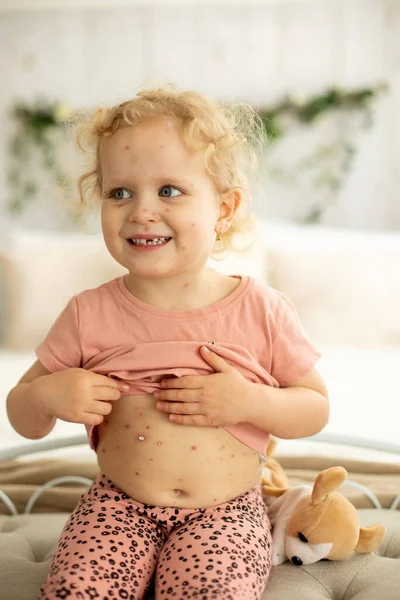 Bambina Bambina Con Varicella Letto Giocare Casa Isolamento Quarantena Durante — Foto Stock