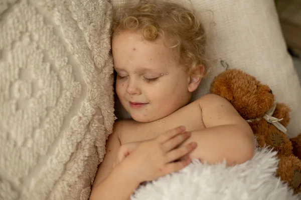 Kisgyermek Lány Bárányhimlővel Ágyban Játszik Otthon Karantén Elkülönítés Betegség Alatt — Stock Fotó