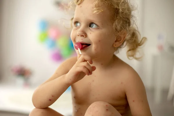 Liten Småbarn Flicka Med Vattkoppor Sängen Leka Hemma Karantän Isolering — Stockfoto