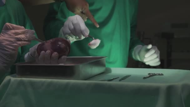 Chirurgický Tým Specializované Chirurgie Transplantace Srdce Pacientem Pro Záchranu Případě — Stock video