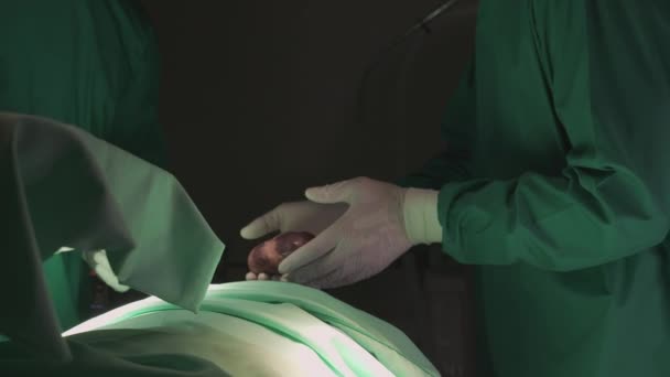 Chirurgický Tým Specializované Chirurgie Transplantace Srdce Pacientem Pro Záchranu Případě — Stock video