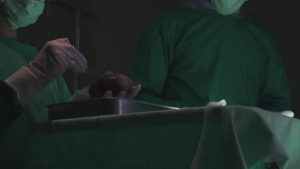 Surgeon Team Specialist Surgery Transplant Heart Patient Rescue While Emergency — Stockvideo