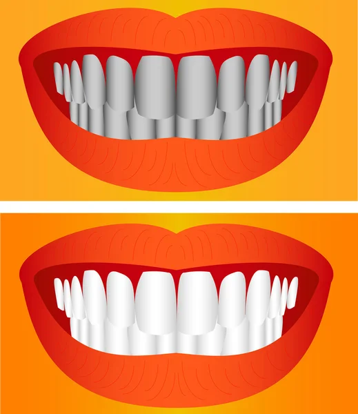 Care of teeth — Stock Vector