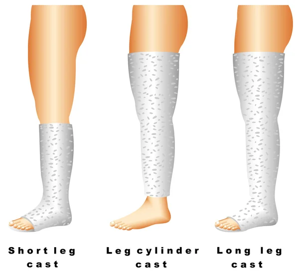 Lemparan kaki - Stok Vektor