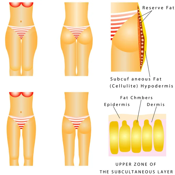 Cuisses grasses — Image vectorielle