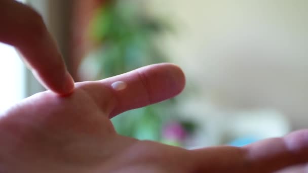 Close Shooting Young Man Touching Big Blister Thumb His Left — Stock Video