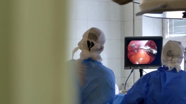 医者は腫瘍を除去する手術を行う Hirurgは医療機器を制御し 患者の内臓の画面を見て — ストック動画