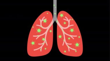 Koronavirüs enfeksiyonu, MG animasyonu, çizgi film tarzı.