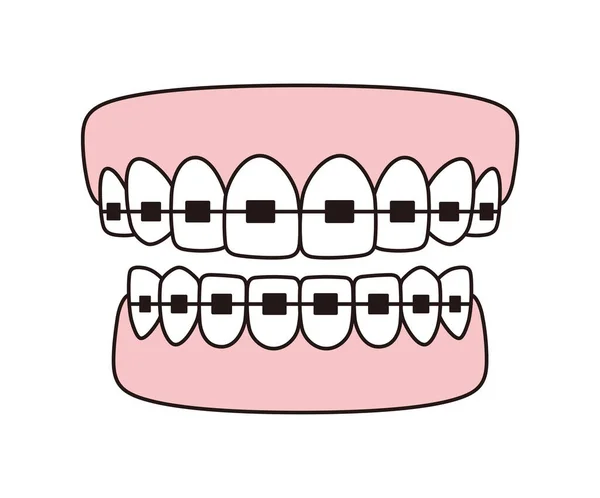 Zahnspange Symbole Vektor Flache Abbildung — Stockvektor