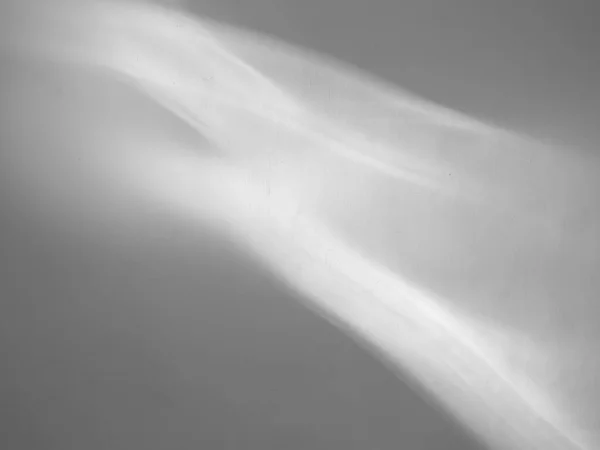 光のパターンを持つ灰色の抽象的な背景 — ストック写真