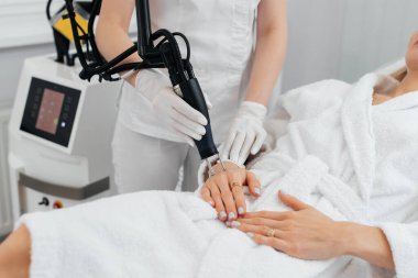 Genç bir kız güzellik salonunda ellerinin derisi için karbon soyuluyor. Lazer darbeleri deriyi temizler. Donanım kozmetolojisi. Fototermoliz süreci, deriyi ısıtır..