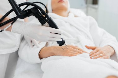 Genç bir kız güzellik salonunda ellerinin derisi için karbon soyuluyor. Lazer darbeleri deriyi temizler. Donanım kozmetolojisi. Fototermoliz süreci, deriyi ısıtır..